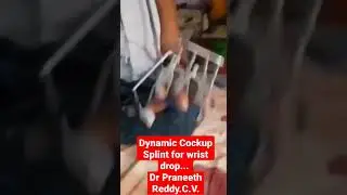 Dynamic wrist cockup splint for wrist drop... Dr Praneeth Reddy.C.V