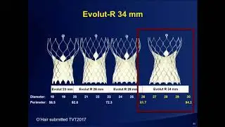 Evolut Pro: A Legacy of Superior Outcomes - Jeffrey Popma, MD