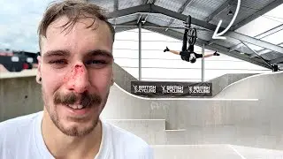 OUCH SAVAGE  BROKEN NOSE & MASSIVE BMX SENDS!🤯