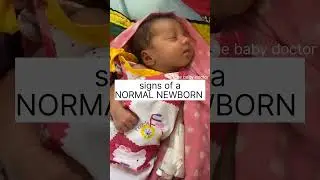 signs of NORMAL NEWBORN| pediatrics| the baby doctor #newborn #shorts #babyvideos