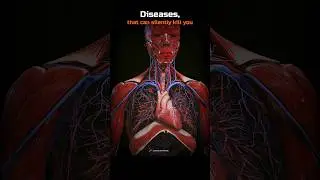 Diseases, that can silently kill you! 💀🤯 #Shorts #Biology #Science #Animals #Anatomy #Organs