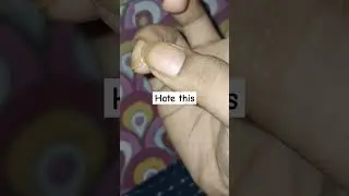 Who also hate chipped nails 😖😣😞