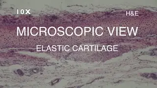 MICROSCOPIC VIEW - ELASTIC CARTILAGE