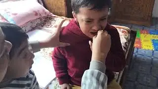 Tooth extraction 3