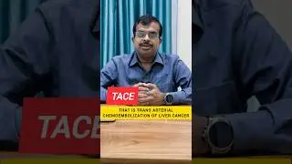 TACE for Liver Cancer | Trans Arterial Chemo Embolization | Dr Arup Karmakar MD DNB  #livercancer