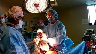 Giving birth in Canada, C-Section Ottawa Hospital Civic Campus. Having a baby in Canada