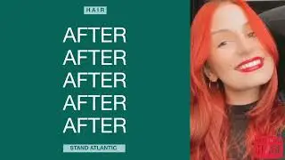 Stand Atlantic CURES hair loss?!