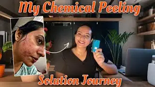 Glass Skin in 7 days⚠️Chemical peeling solution before & After journey| Skincare videos in kannada🌷