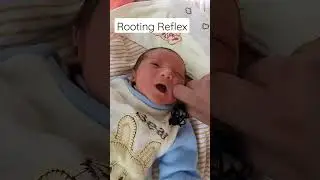 Rooting Reflex in newborn #paediatric #newborn  #neonatologist