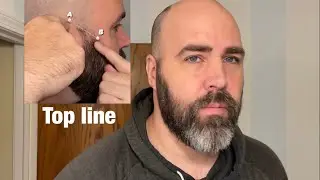 Top Line of the Beard