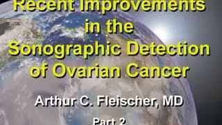 SONOWORLD   Recent Improvements in the Sonographic Detection of Ovarian Cancer Arthur C  Fleischer,