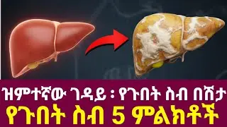 ዝምተኛው እና አስከፊው ገዳይ በሽታ ፡ የጉበት ስብ በሽታ ምልክቶቹ  | Fatty liver disease symptoms