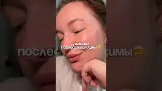 А ты сталкиваешься с данной проблемой?🥺