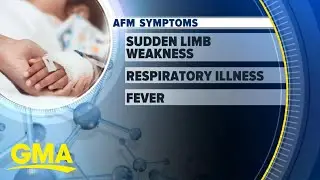 Dr. Ashton discusses CDC&rsquo;s warning about potential AFM outbreak among children l GMA
