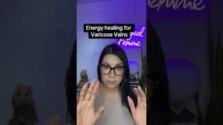 Energy Healing for Varicose veins #energyhealing #varicoseveins