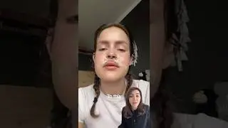 The Jaw Surgery Journey!