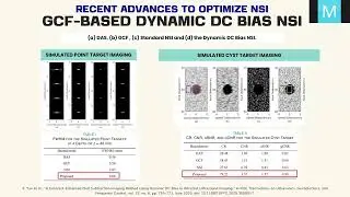 Enhancement of Null Subtraction Imaging in Ultrafast Ultrasound Beamforming - 1IBM09