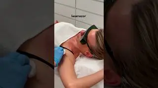 Achseln Laser Behandlung ist beliebt vor allem bei Sportlern.