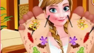 Frozen Anna Foot Doctor | Game for Little Girls | Doctor Games
