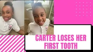 PULLING CARTER'S FIRST TOOTH OUT! (DRAMATIC REACTION)