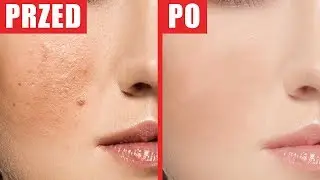 3 sposoby jak usunąć pryszcze! Photoshop Tutorial