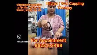 #Hijama #wetcupping #Physiotherapy #chiropactic #chiropractor 