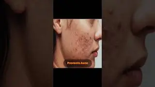 5 Reasons to use Face Scrub | Vestige Assure Natural Face Scrub | #shorts #vestige #wishyouwellth
