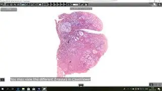 3DHISTECH - Pannoramic Scanner Software 2.1 Tutorial - Z-Stack Flash scanning