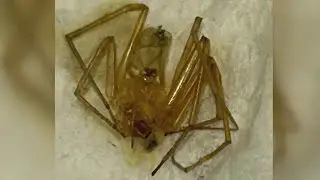 Woman sues apartment complex after spider bites lead to toe amputations