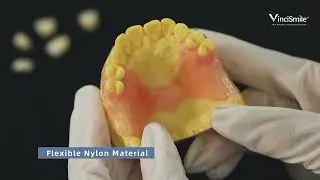 Flexible Partial Dentures Workflow