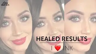 Healed Results: I Love Ink | Tina Davies