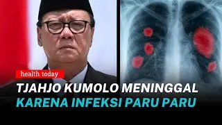 Menteri Tjahjo Kumolo Meninggal Karena Infeksi Paru-paru, Kenali Penyebabnya | Health Today #154