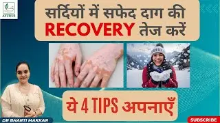 4 Simple tips for fastest recovery in Vitiligo in Winters | By Dr. Bharti Makkar #ayurveda