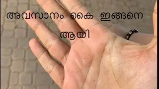 Day in my life☘️🍂 ഇങ്ങനെയും ചില ദിവസങ്ങൾ😇 അവസാനം കൈ ഇങ്ങനെ ആയി