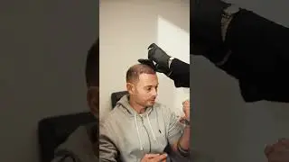 Haarausfall stoppen mit PRP (Eigenblut)
