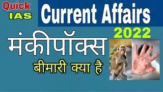 monkeypox virus (मंकीपॉक्स वायरस ) part -7#monkeypoxvirus#virus#upcscurrentaffairs#currentaffairs