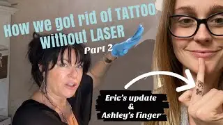 PT. 2 ~ IT&rsquo;s WORKING!!! REMOVE TATTOOS  NO LASER ~ BEFORE AND AFTER ~ Salt Saline Lime DIY at home