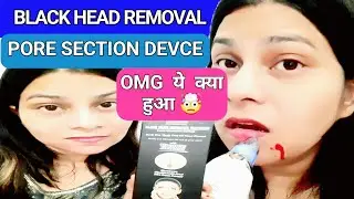 Trying Meesho Amazon Nykaa Products Black Head Removal | Pore Cleaner Device Does it Work 😱