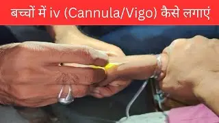 How to put IV Cannula (VIGO) in a child?| Pediatric IV Line | Medical Video #VigoCannula #viral