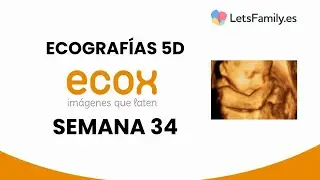 Ecograf&iacute;a 5D: semana 34 de embarazo