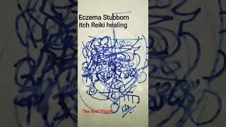 Eczema Stubborn Itch Skin Disease Powerful Reiki healing #youtubeshorts #asmrreiki#eczema#skinreiki
