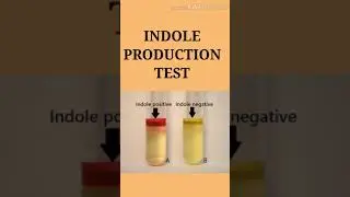 Indole production test