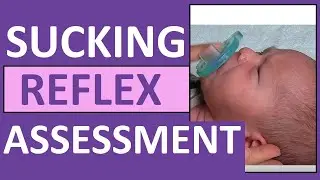 Newborn Sucking Reflex in Infant | Pediatric Nursing Assessment Exam Skill