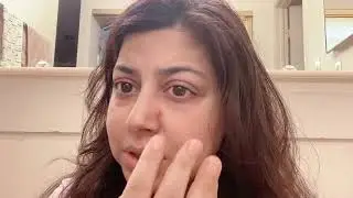 Acne Hack - Nexcare Acne patch; how to make it go away without any blemishes