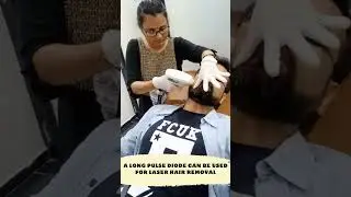 Male beard laser treatment