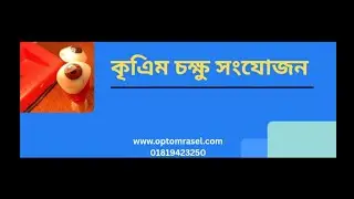 Best Artificial Eye service in Bangladesh 