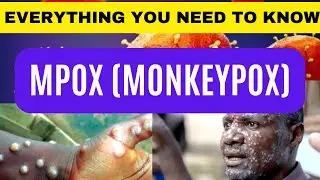 What is MPOX (Monkeypox)? |  Monkeypox Outbreak 2024