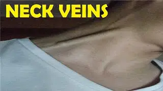 how to get neck veins exercise