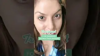 Fix the broken skin barrier