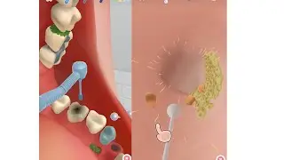 teeth cleaning ear cleaning| treatment animation video #kidsvideo #satisfying #treatment